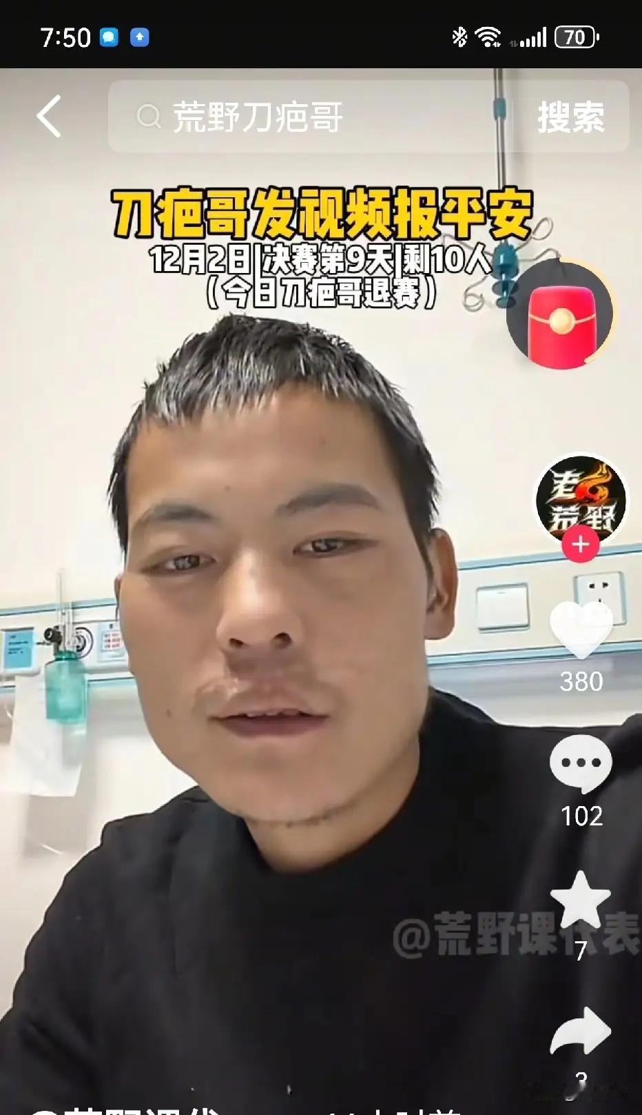 普通人逆袭成功的事情真的太少，
现在不替刀疤哥diss节目组或者品牌方。
是怎么