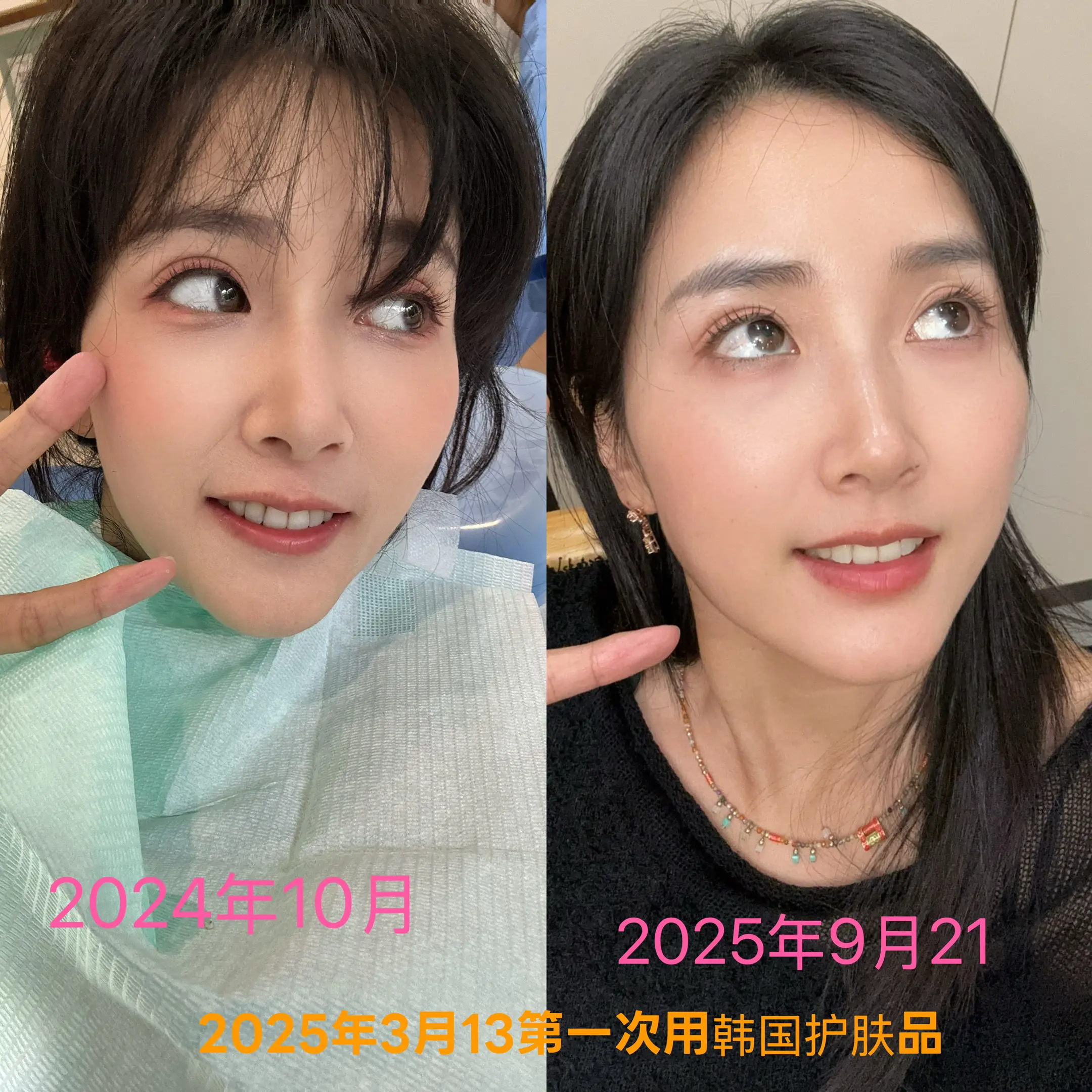 用效果说话吧，为啥我那么爱这份事业，这么喜欢韩国这款护肤品，自体细胞再...