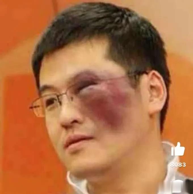杨毅你给我们站出来！你不是说约基奇需要找状态吗？论打脸，杨毅说第一，谁敢说第二呢