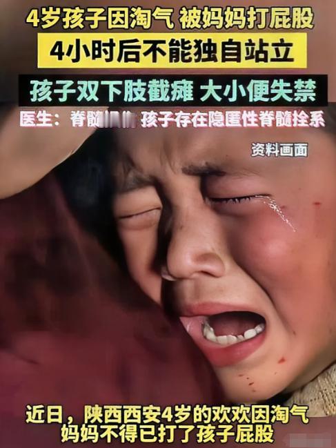打孩子千万要适度！陕西4岁孩子因淘气被家长打屁股，导致孩子下肢瘫痪无法站立，大小