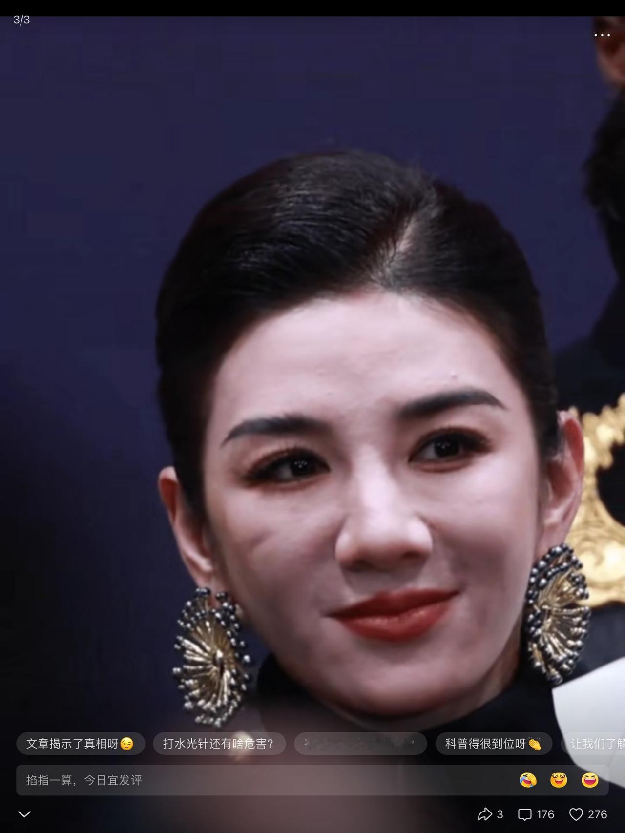 黄奕也没逃过地球引力，你看那嘴角的法令纹多深，脸上的印第安纹，已经把脸腮的肉分离