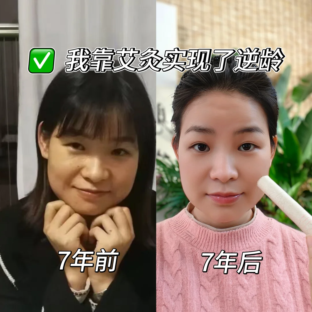 中式养生 | 我真的靠艾灸实现了逆龄🔥