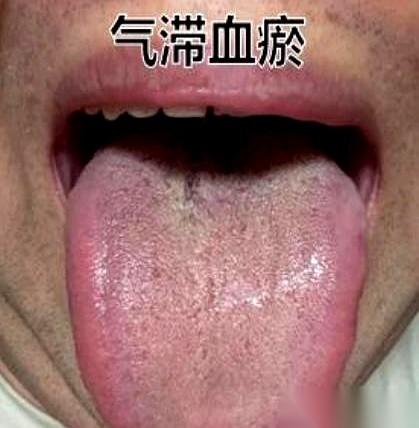 有种男人，人到中年，越补越虚。
几千块一盒的鹿茸海马，当饭一样吃。想着龙精虎猛，