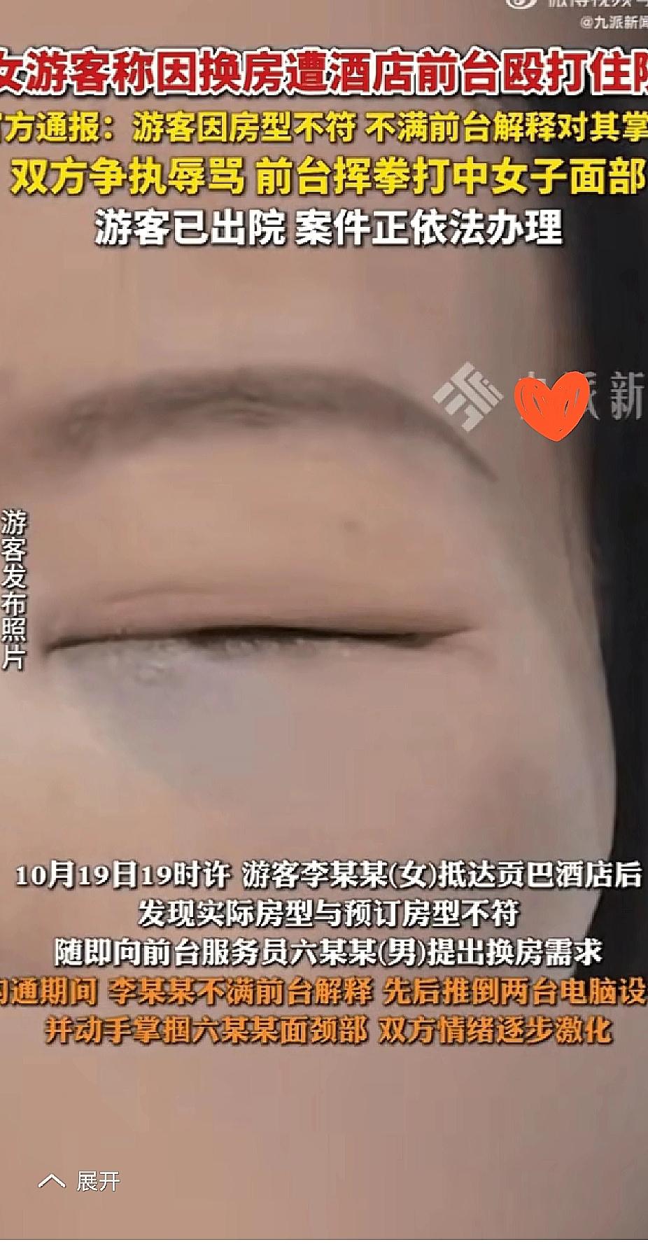 
女子到九寨沟旅游，没想到一件小事居然让她的行程大打折扣。这女子在酒店预定了房