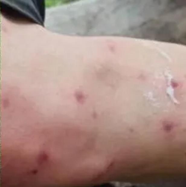 贵州遵义，男子带两网友去摘取马蜂窝后的第二天，导致男子同村亲戚大妈上山摘蘑菇被马