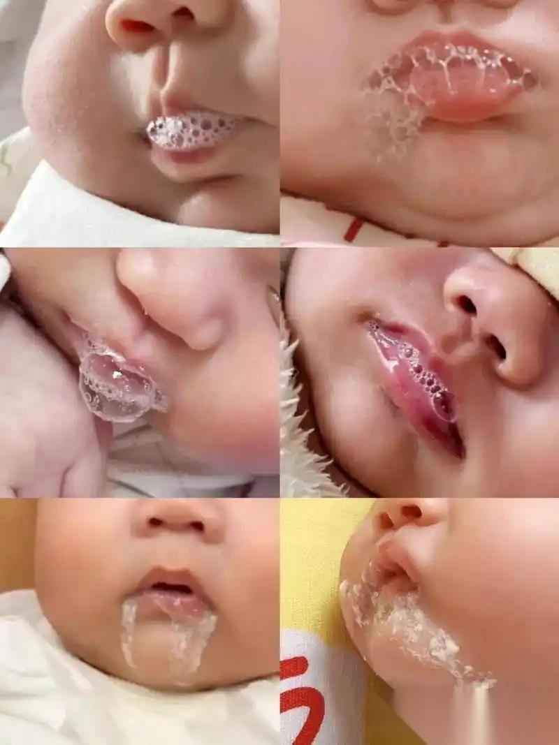 何穗自曝儿子胃食管反流在儿科门诊，婴儿胃食管反流是一个很常见的问题，很多新手爸妈