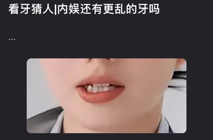 刘浩存的牙齿被审判了，明星牙齿乱影响整体观感吗？ 