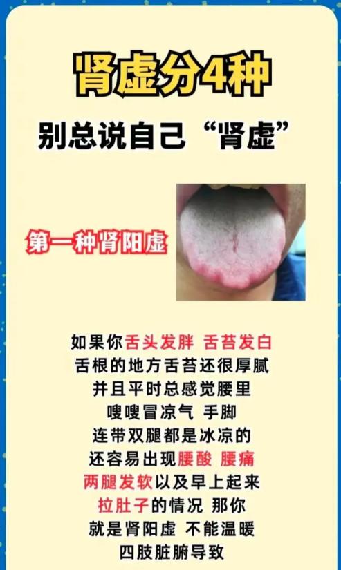 肾虚分 4 类，别再盲目说自己肾虚