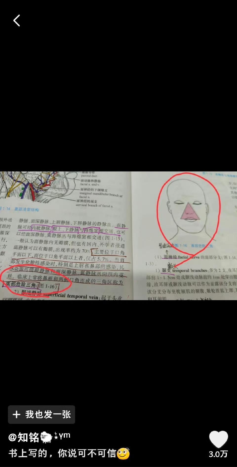 20岁男生挤三角区痘痘，肺被啃出10多个空洞！这个禁区千万别碰
 
刷到这条新闻