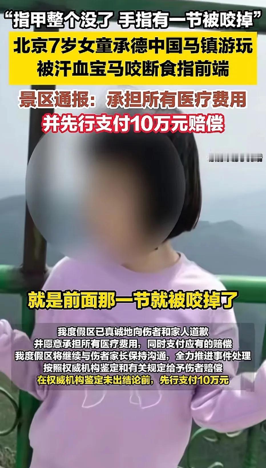 河北承德，父母带着七岁的女儿前往中国马镇游玩。当女孩伸手喂马吃胡萝卜的时候，被马