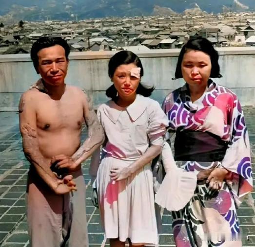 1945年，广岛原子弹爆炸后，三个幸存者，留下了这一张照片，镜头中的他们眼神非常