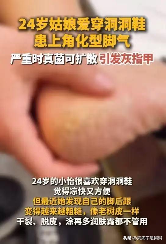 “万万没想到！”6月26日报道，浙江杭州，一女子天气一热，就喜欢穿洞洞鞋，觉得凉
