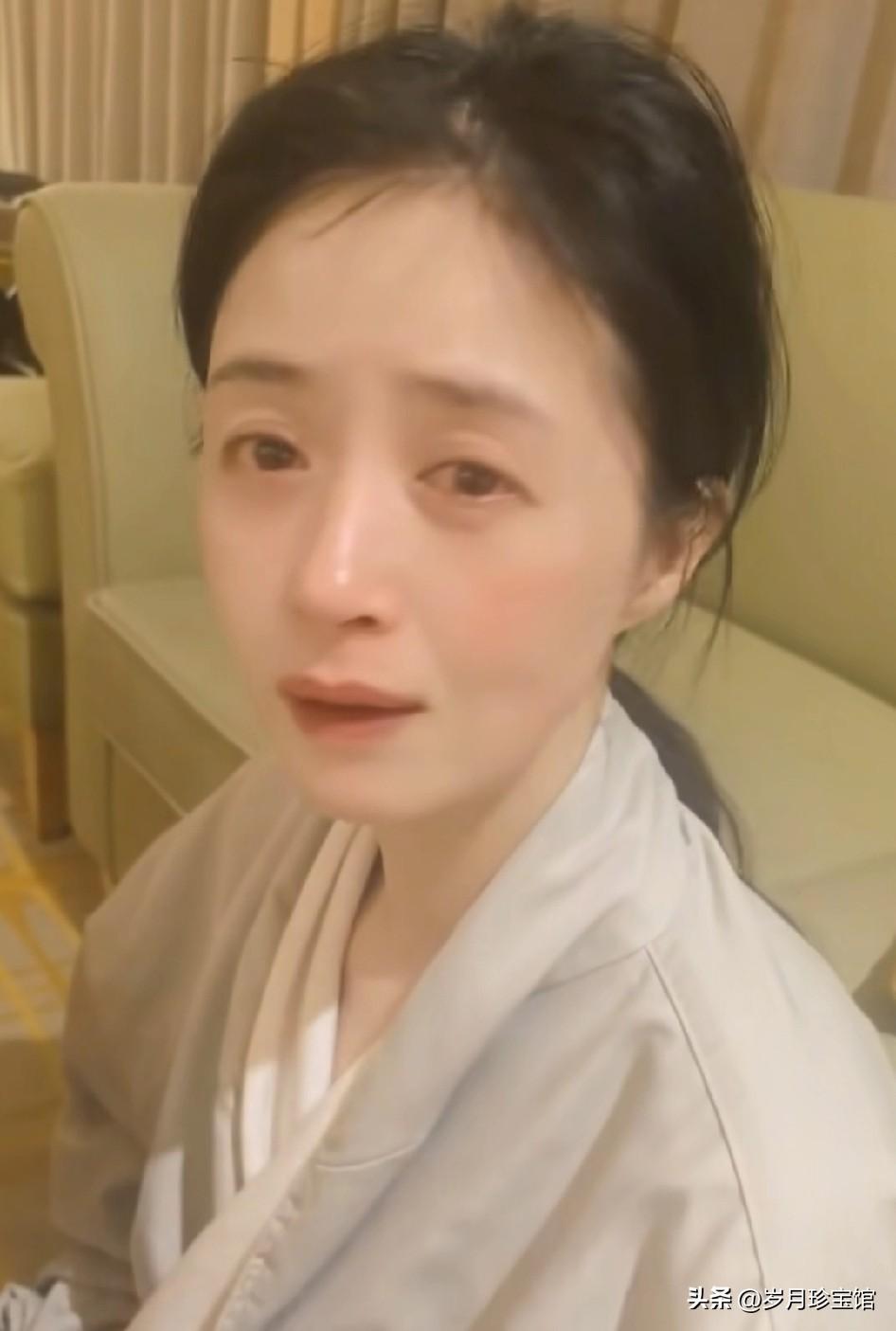 发现了吗，长期营养不良已经让蒋欣严重脱发。

我们知道，作为易胖体质的蒋欣为了保