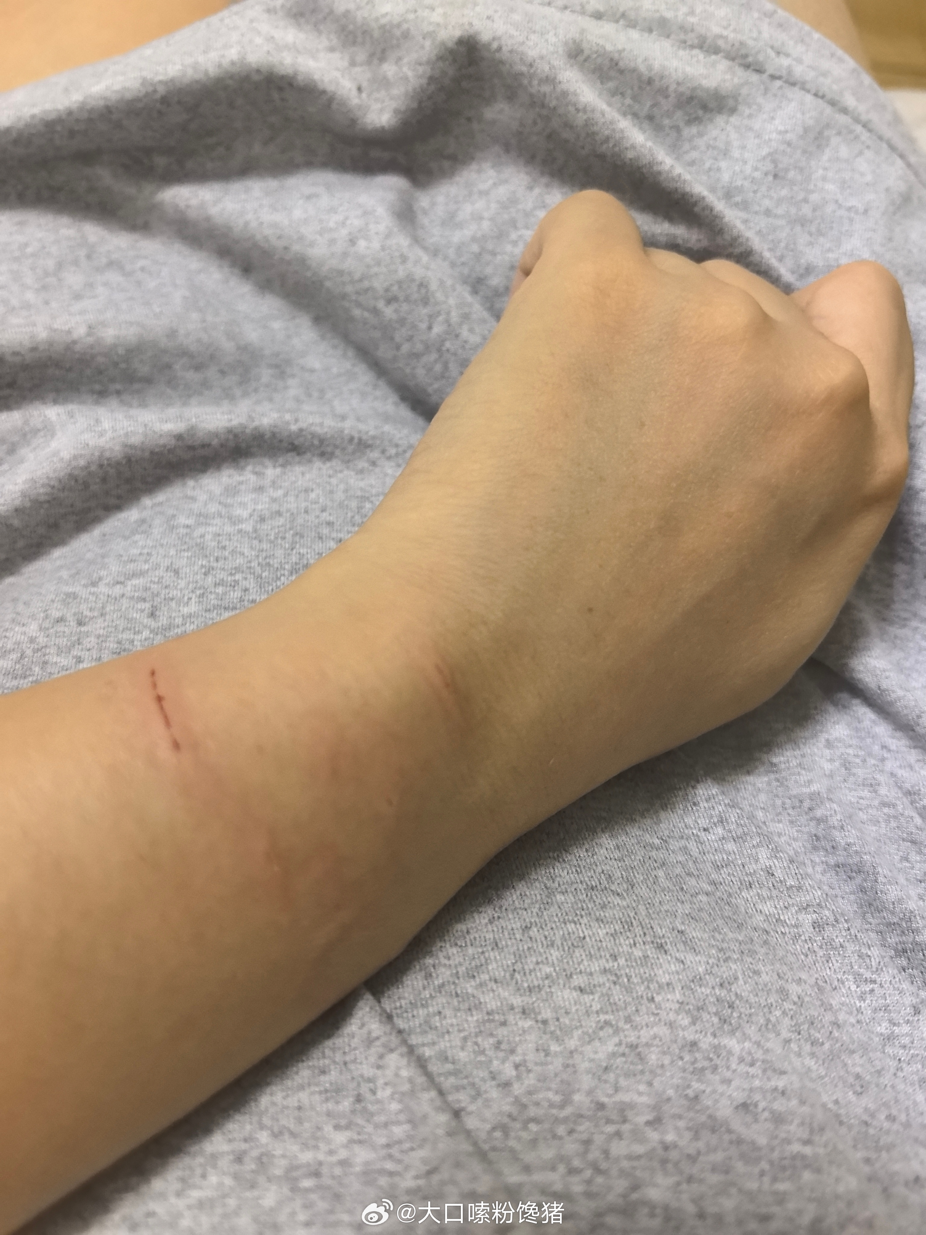 养猫人底线低过底裤每次被咬被抓当时气得要死 过几分钟后算了算了他只是一只喵能懂什