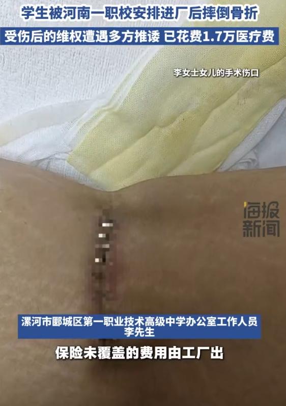 “比周扒皮都黑！”7月16日海报新闻报道，河南漯河，一名学旅游管理的女生，被学校