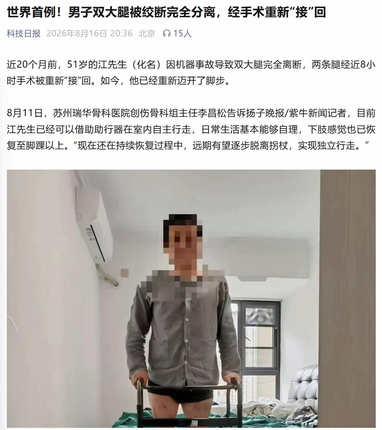 世界医学奇迹！双腿完全绞断8小时手术再接，20个月后他重新站起
 
这几天，《科