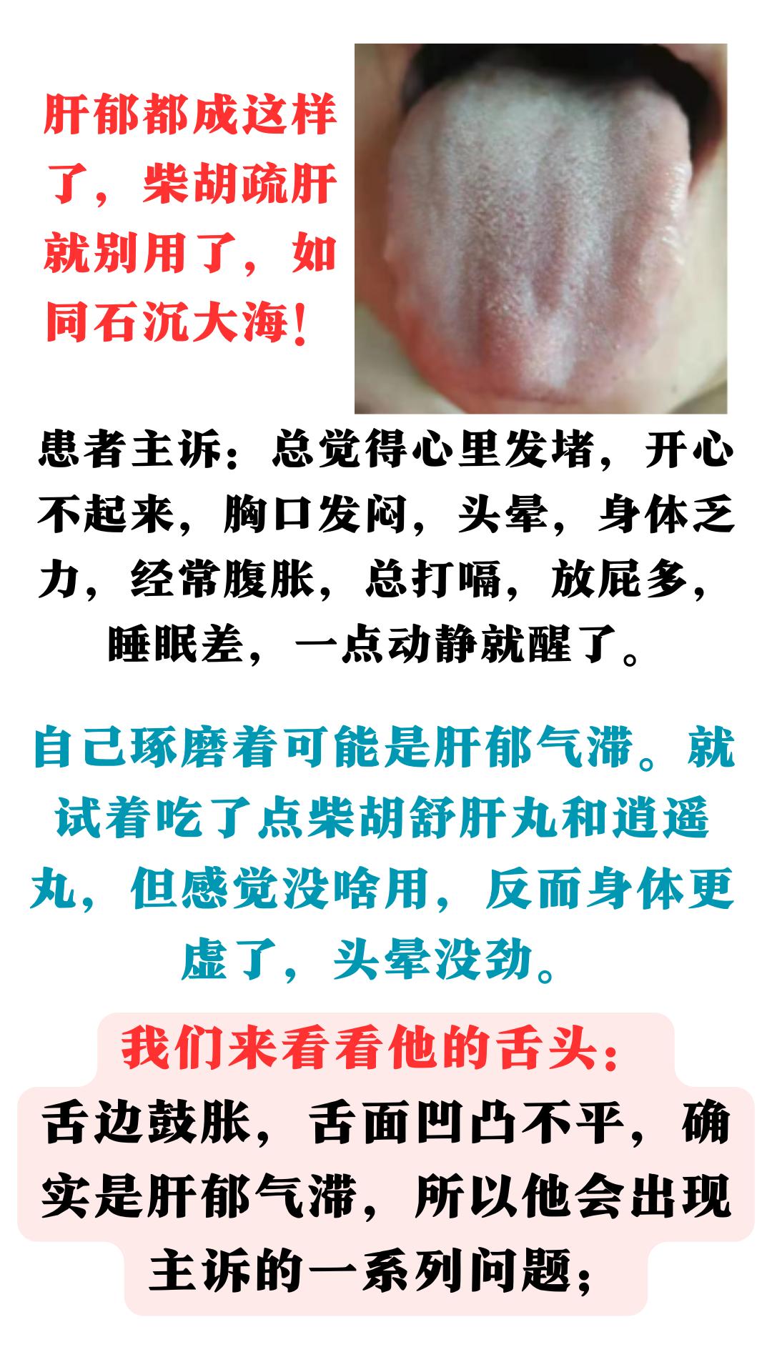 肝郁都成这样了，柴胡疏肝就别用了，如同石沉大海！#中医##中药##健康科普#