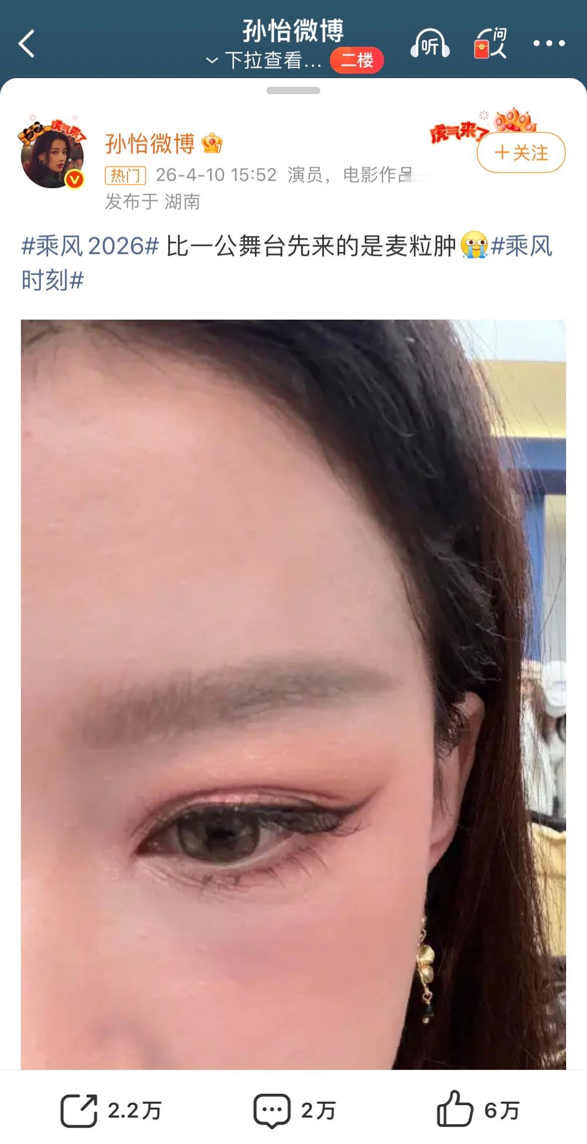 者来家族cos孙怡麦粒肿前几天看到孙怡的麦粒肿状况还挺担心的，结果今天就被者来家