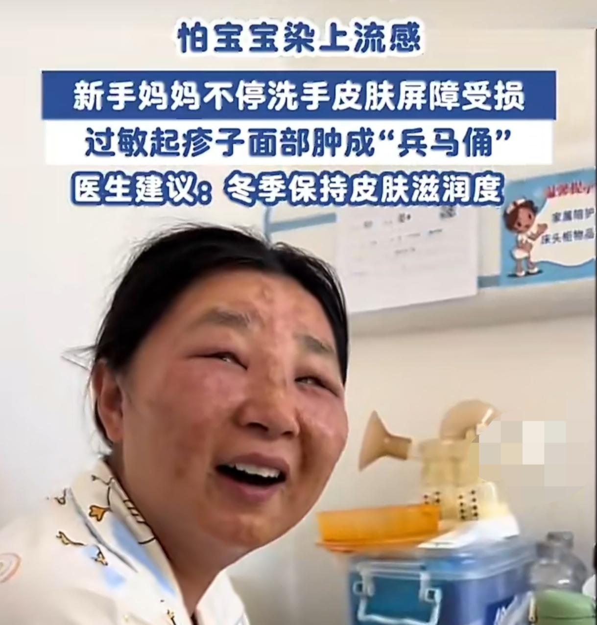 新手宝妈洗手洗进医院 过度清洁致脸变形 新手爸妈的焦虑有多可怕
 
新手爸妈的焦