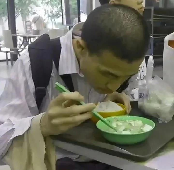北大吓坏了！韦东奕掉了三颗牙，网友生气嫌学校不关心天才的生活。从早期采访视频看出
