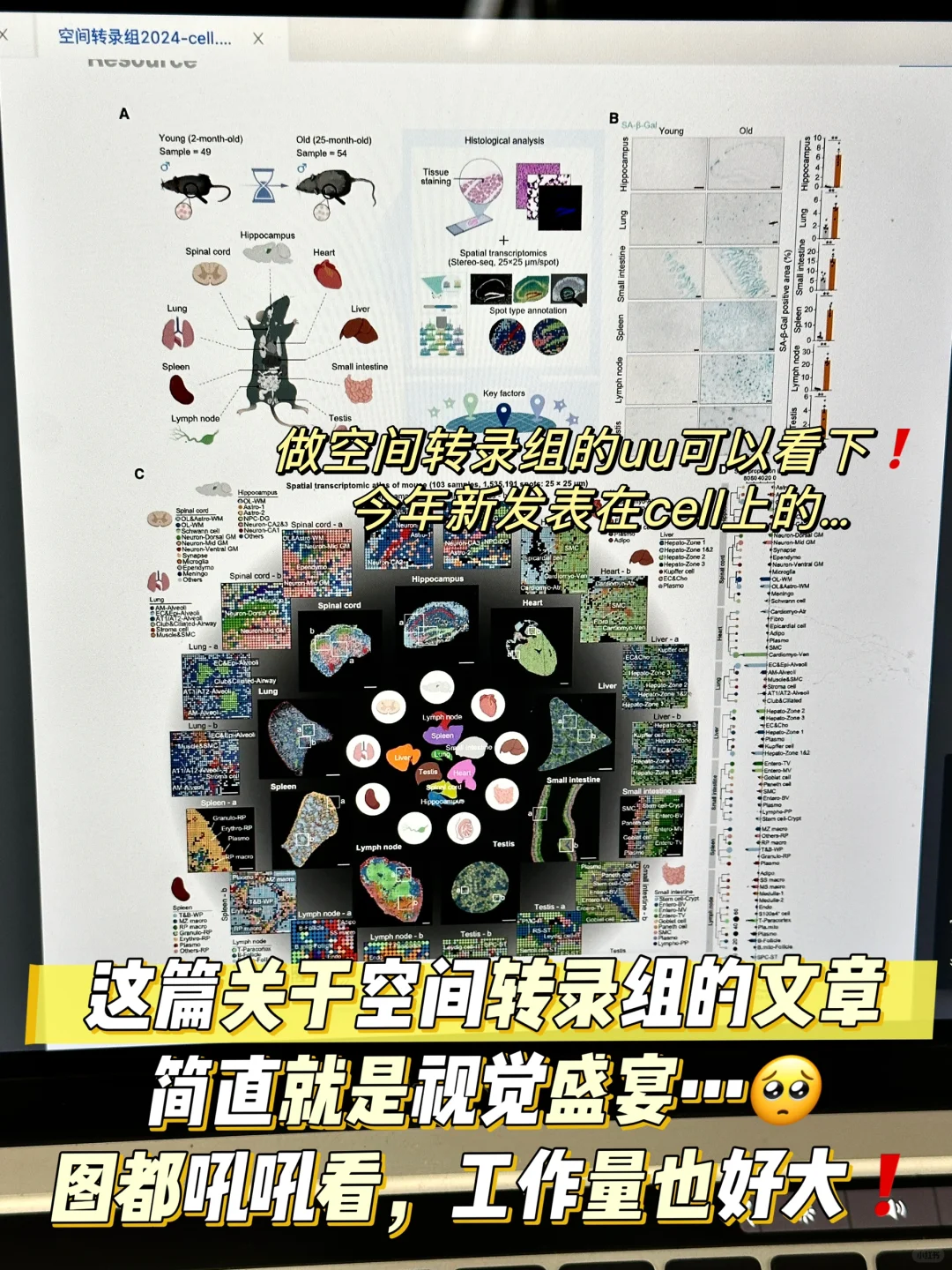 普通转录组，单细胞转录组，空间转录组区别❓