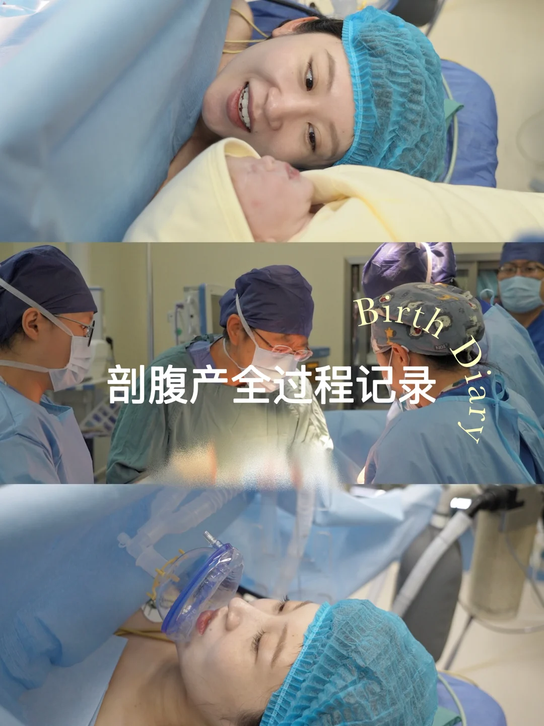 私立🏥剖腹产真实经历&产后恢复👩🏻‍🍼