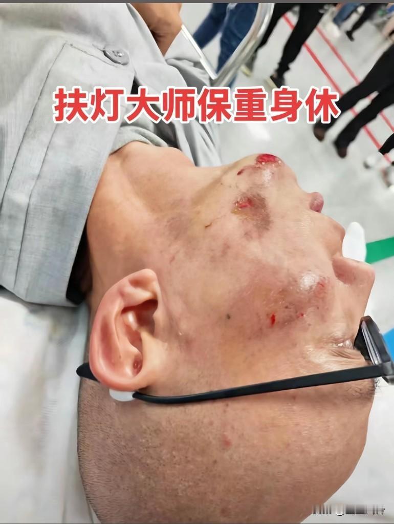 扶灯大师保重身体！好遗憾，万恶资本，宗教只要商业化，就离远点！
什么宗教，M宗啥