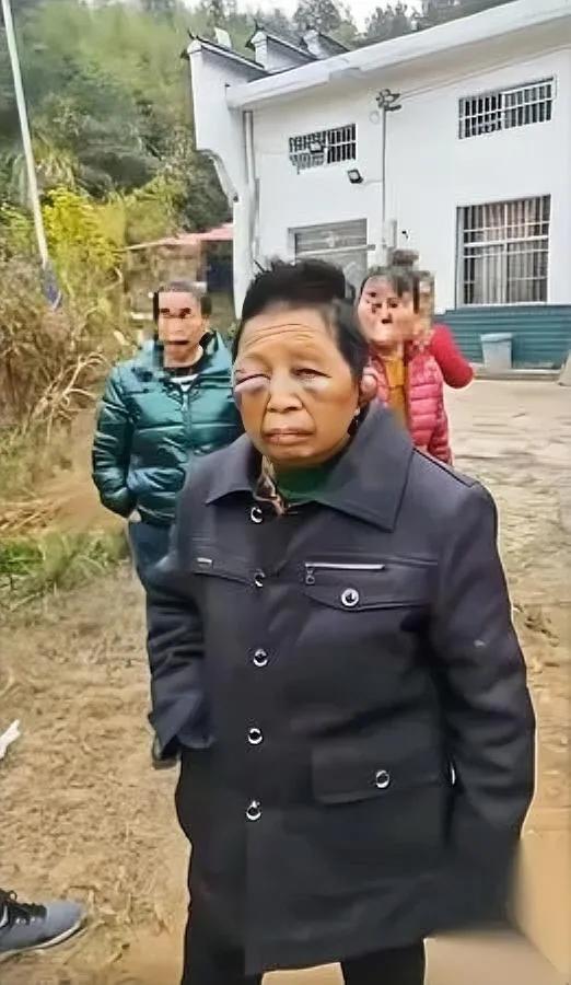 40岁活成60岁！湖南大姐…

满身伤痕的她为何无人救？

湖南平江这位大姐，被