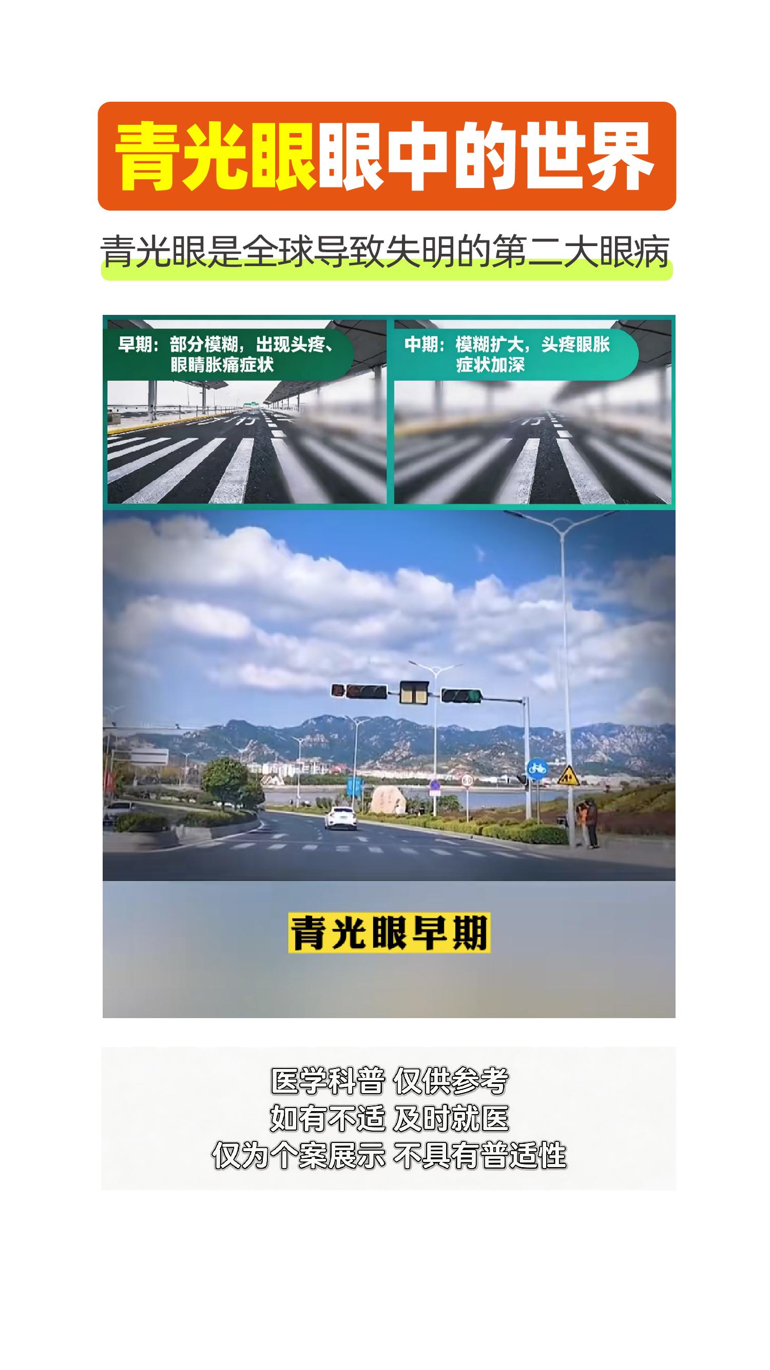 青光眼眼中的世界。