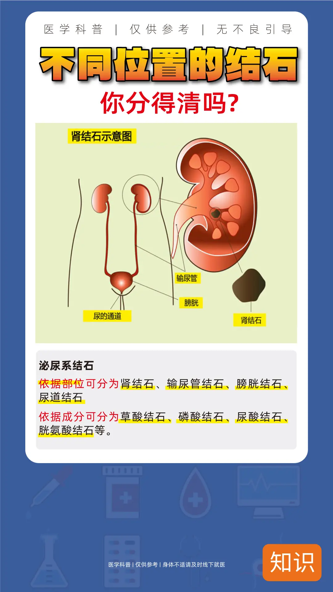 不同位置的结石，你分得清吗？？