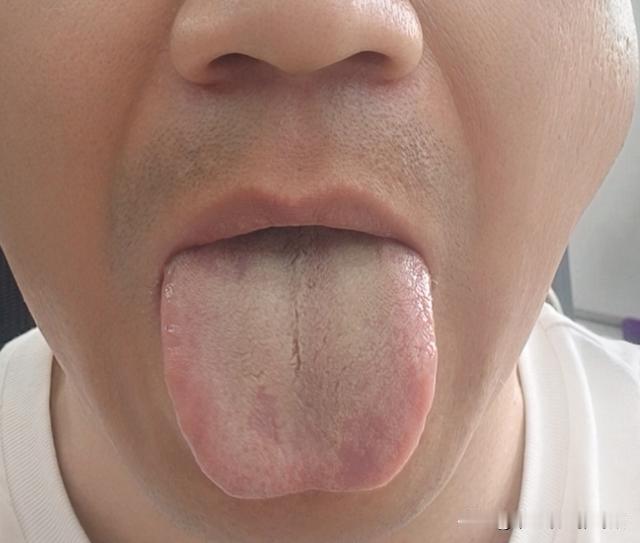 这大哥，也是够狠的，直接把自己掏空了[捂脸][捂脸][捂脸]
这一看就虚的不像话