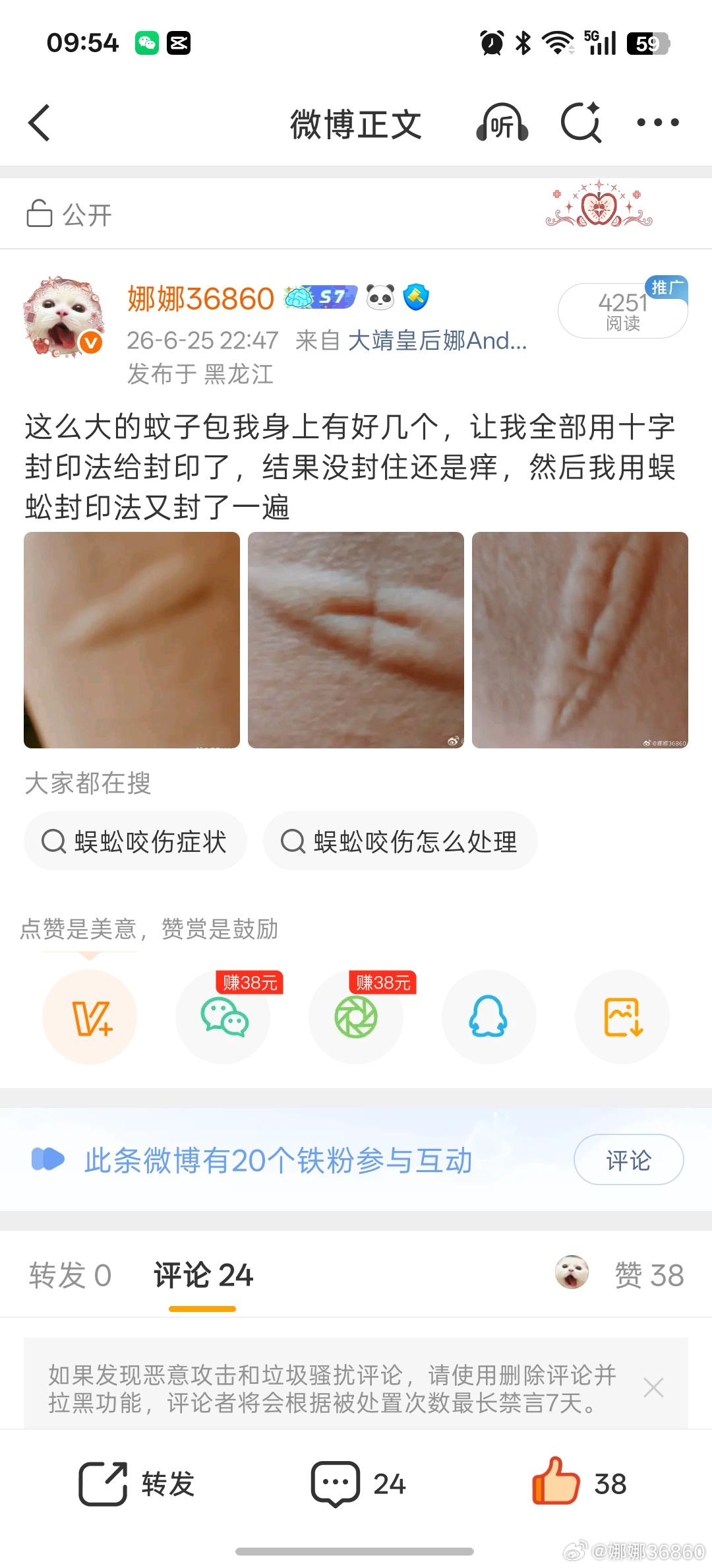书接上回:生活小妙招，蚊子咬了涂牙膏图一涂牙膏前，图二涂牙膏后只剩下一个小红点已