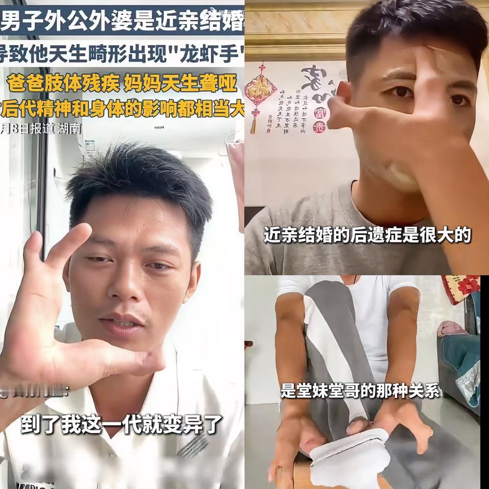 真是疯了
 
都这样了还要结婚生子！
 
湖南一90后男子因外公外婆近亲结婚，导
