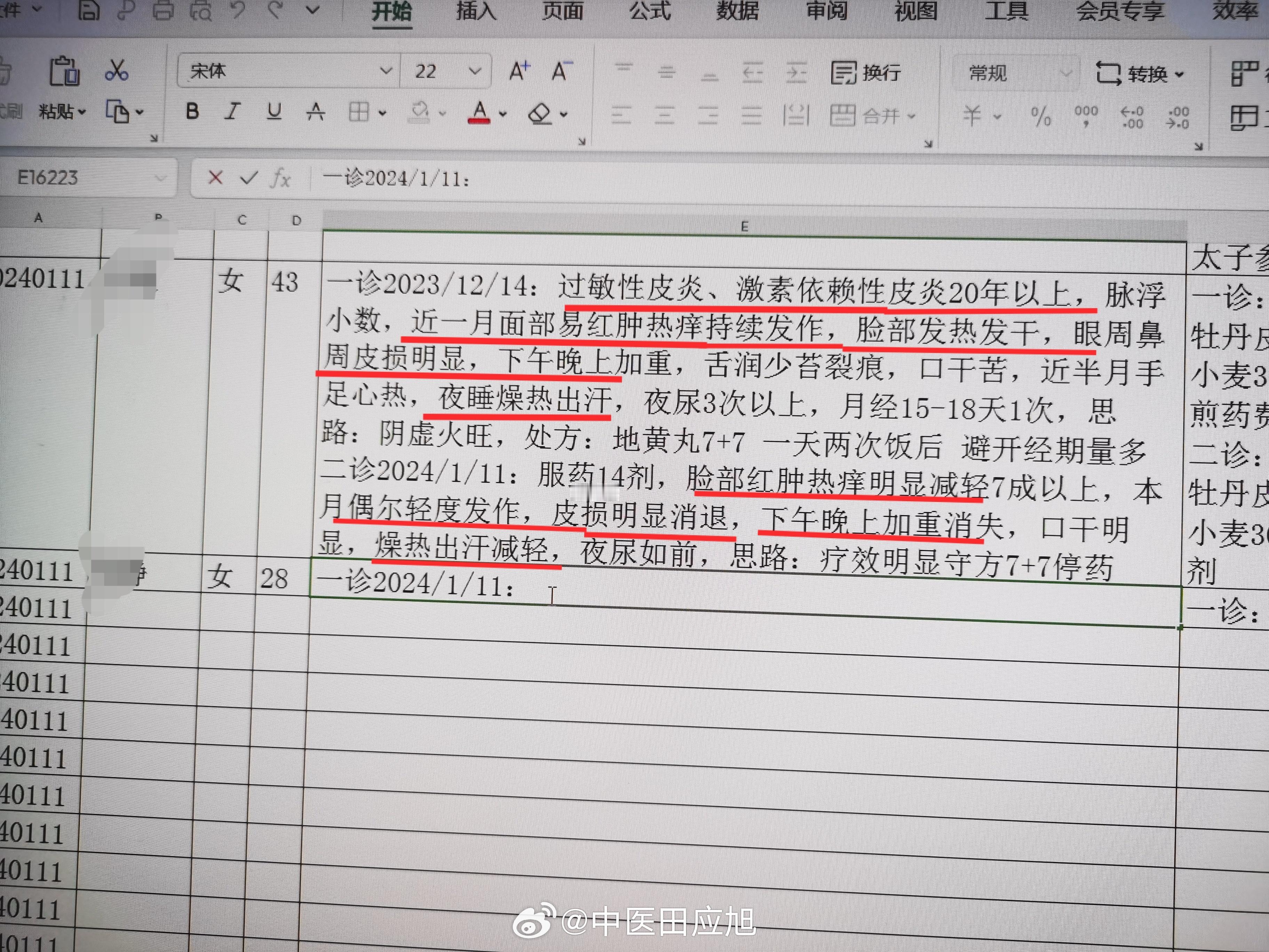#中医##湿疹# 女 过敏性皮炎激素依赖性皮炎20年以上，加重一月，西药外用无效
