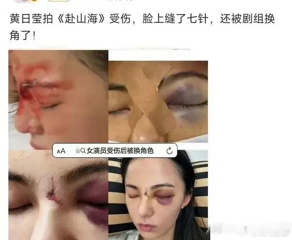 《赴山海》剧组这次肯定后悔了，当初女二是黄日莹，因为拍摄时脸部受伤，就被剧组换人