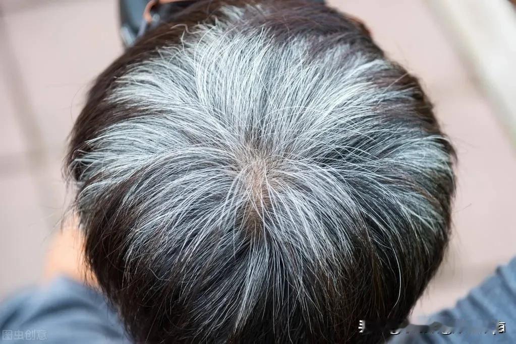 如果有来生多好，38岁已经白发苍苍了，像老年人一样的白发，不知道怎么了，一年比一