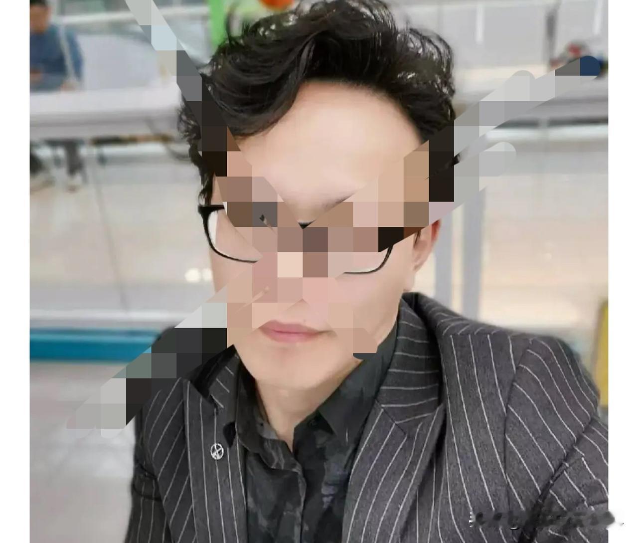 这个该死的人把我的眼睛治坏了一只，太气人了，另一只眼睛的视野也缺损一半，厦门华西