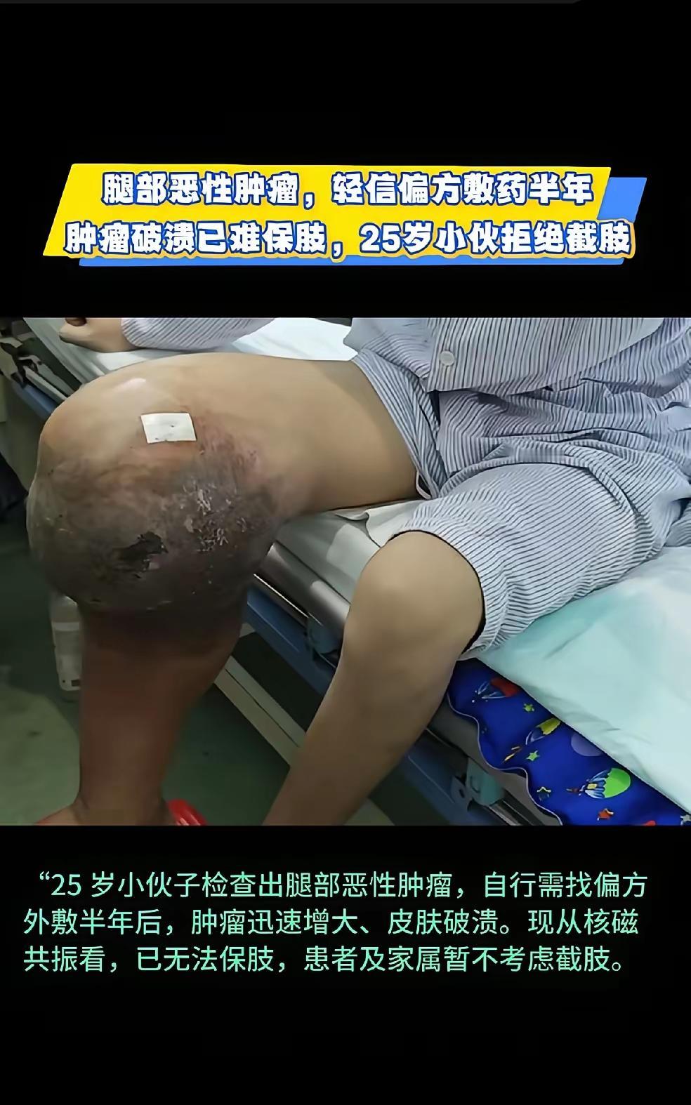 说实话
就是没钱治疗
有钱早挂专家号去看病了
谁还信民间偏方啊