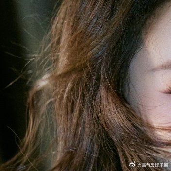 孙怡因染发导致脸肿人没事就好，说实话最好不要染发，染头发的都是化学产品，对身体不