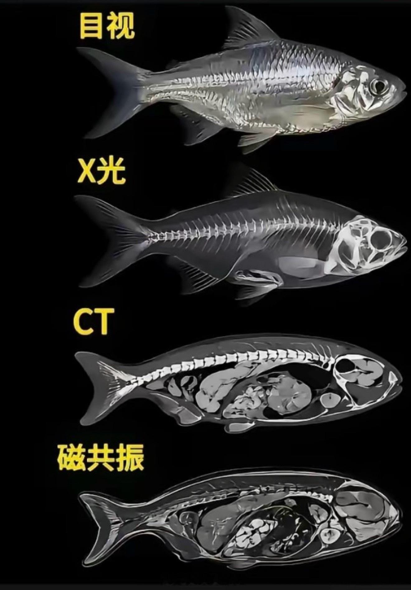 现在知道去医院该拍什么片了吧 ​​​