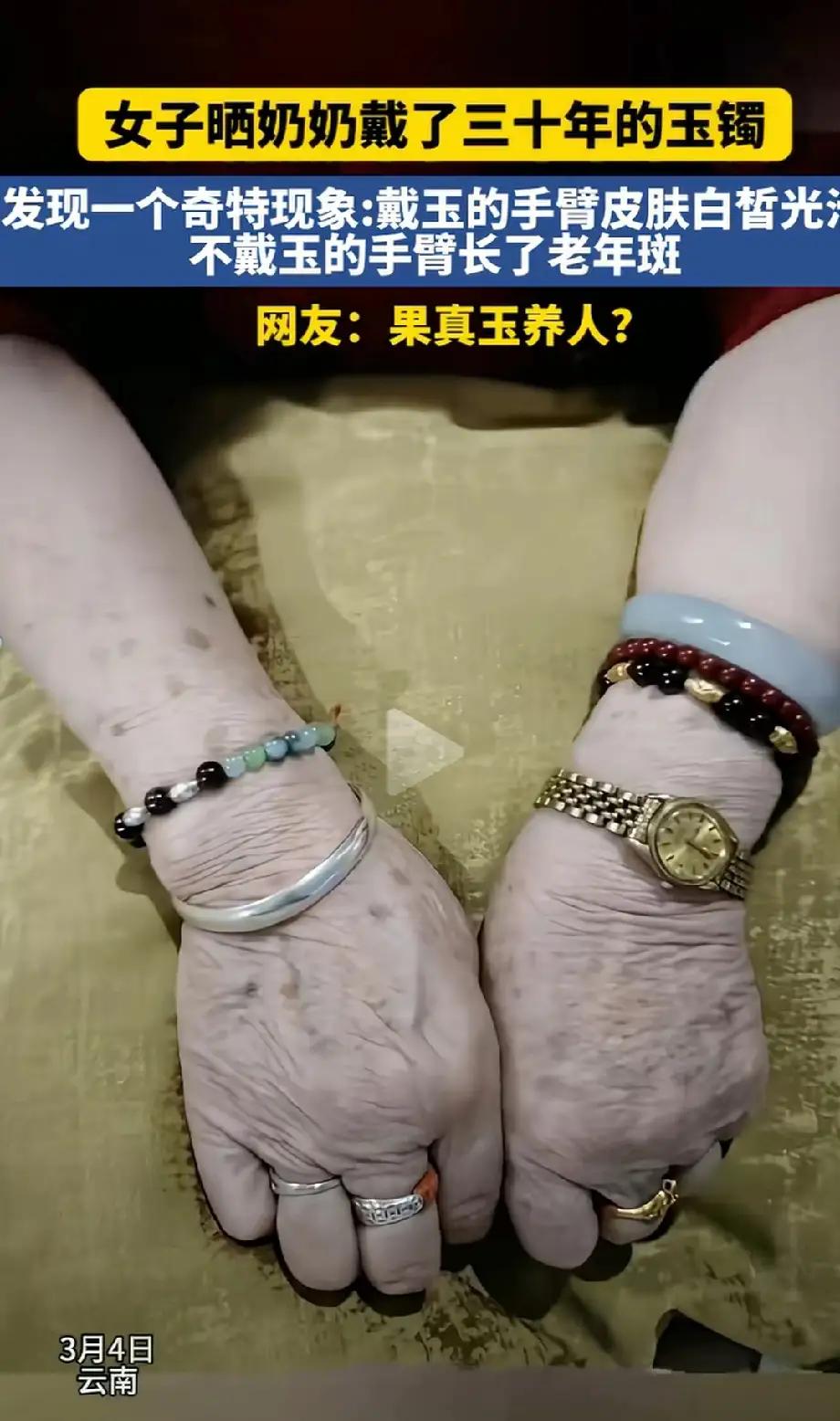奶奶戴30年玉镯，左右手胳膊出现不一样的奇特现象？
玉养人，这是自古都有的说法，