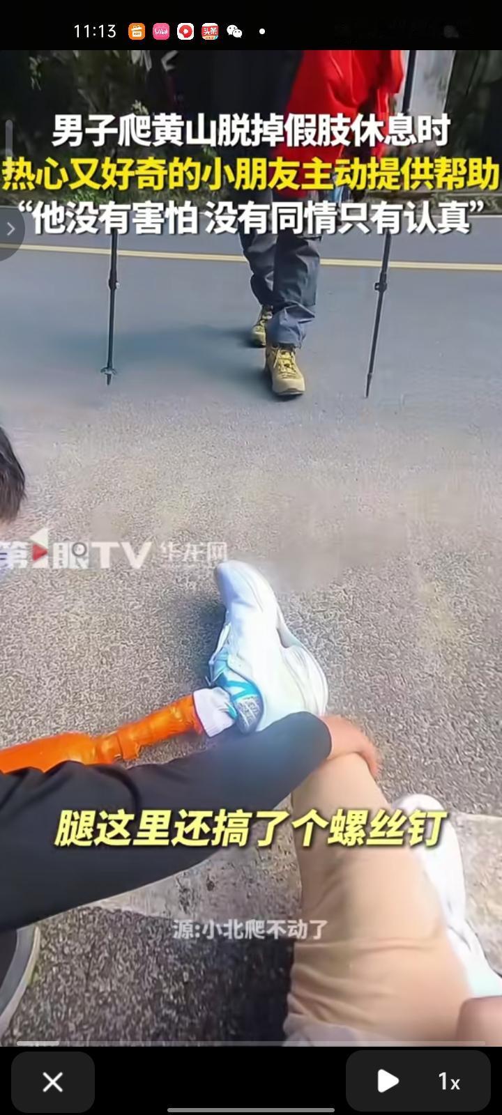 11月29日，安徽黄山。男子爬黄山脱假肢休息时，热心又好奇的小朋友看看他的断腿。