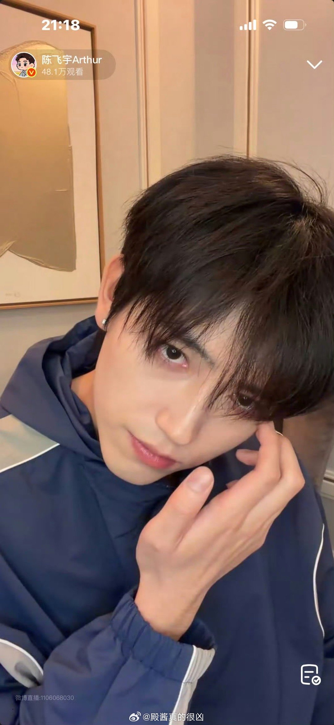 感觉阿瑟很满意自己现在瘦了的样子陈飞宇让方穆扬给自己缝衣服