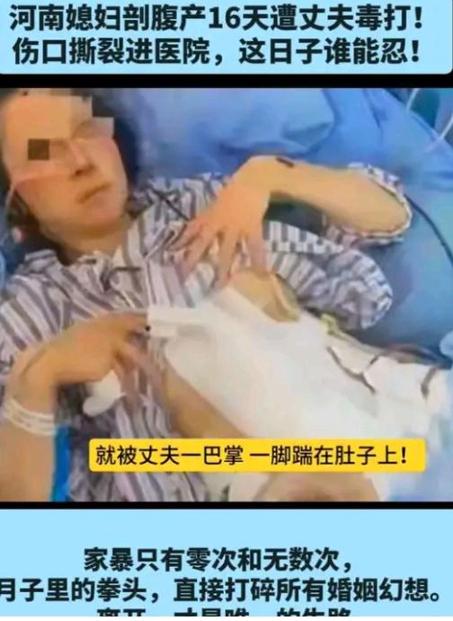剖宫产16天还在淌虚汗的月子期，被丈夫拽头发撞墙、踹向刀口，这哪是夫妻，分明是披