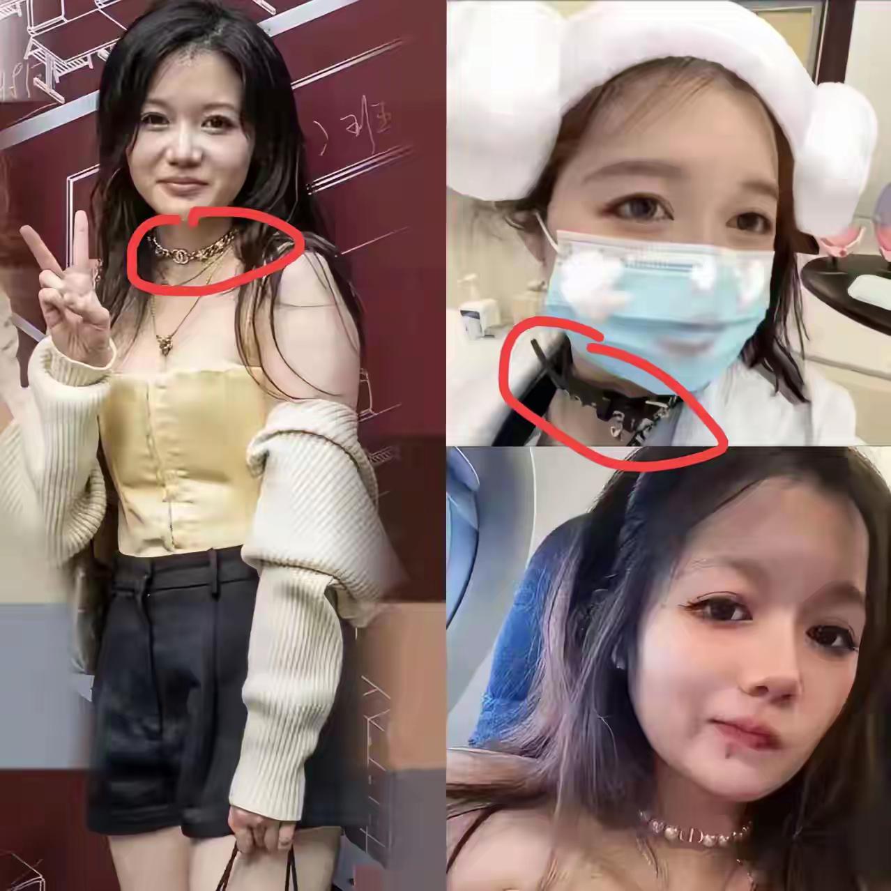 董袭莹脖子上戴的东西确实让人无语！一个医生穿着白大褂，挂着那些花里胡哨的东西，真