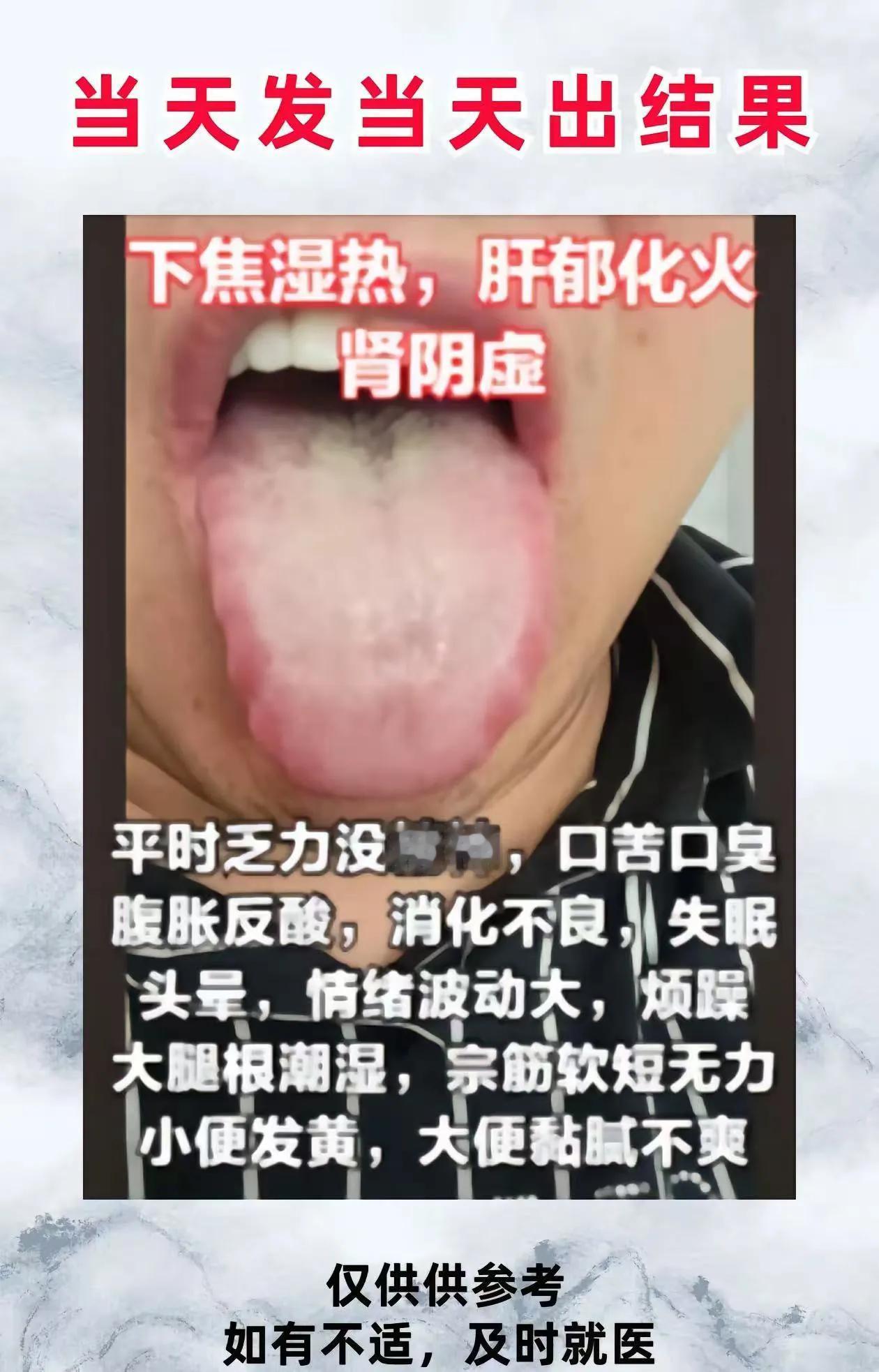 今天有时间，想看舌诊的都可以来，你拍我看，挨个分析！
舌诊