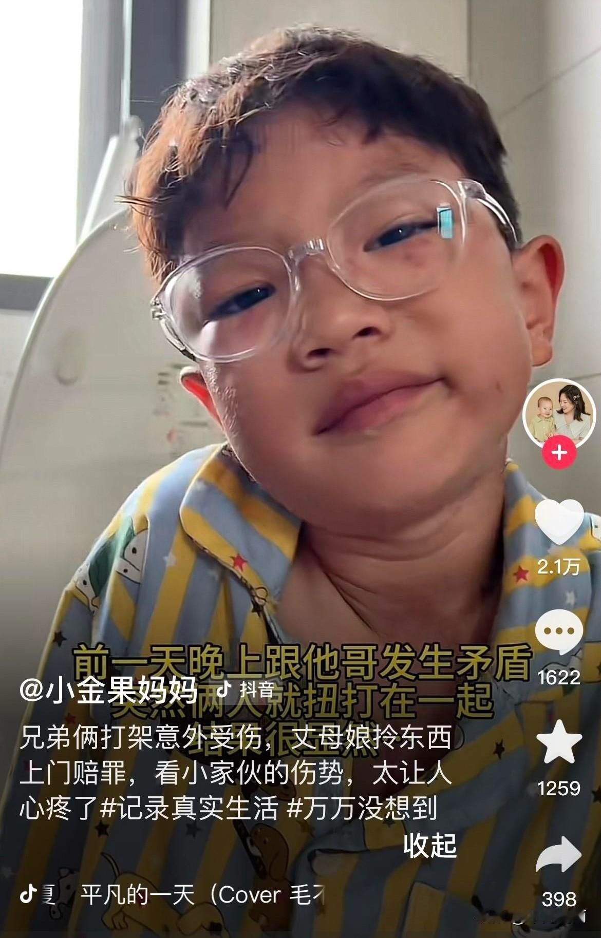 小金果脸被秋天抓伤，金果奶奶发文：心疼到无法呼吸，一夜未眠！
秋天外婆带着礼物去