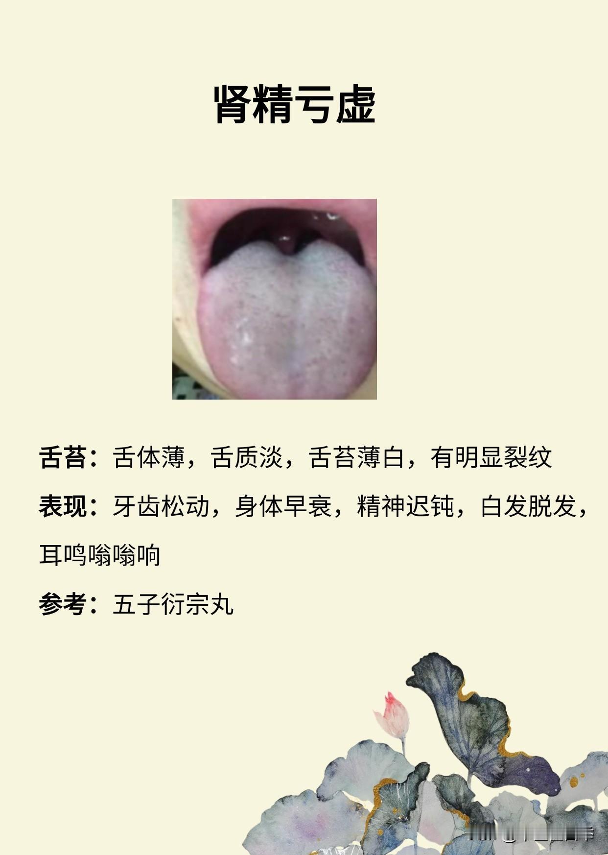肾虚了？别急着补，看看你到底是哪种类型的肾虚，最全肾虚证型分享，抓紧对照
#中医