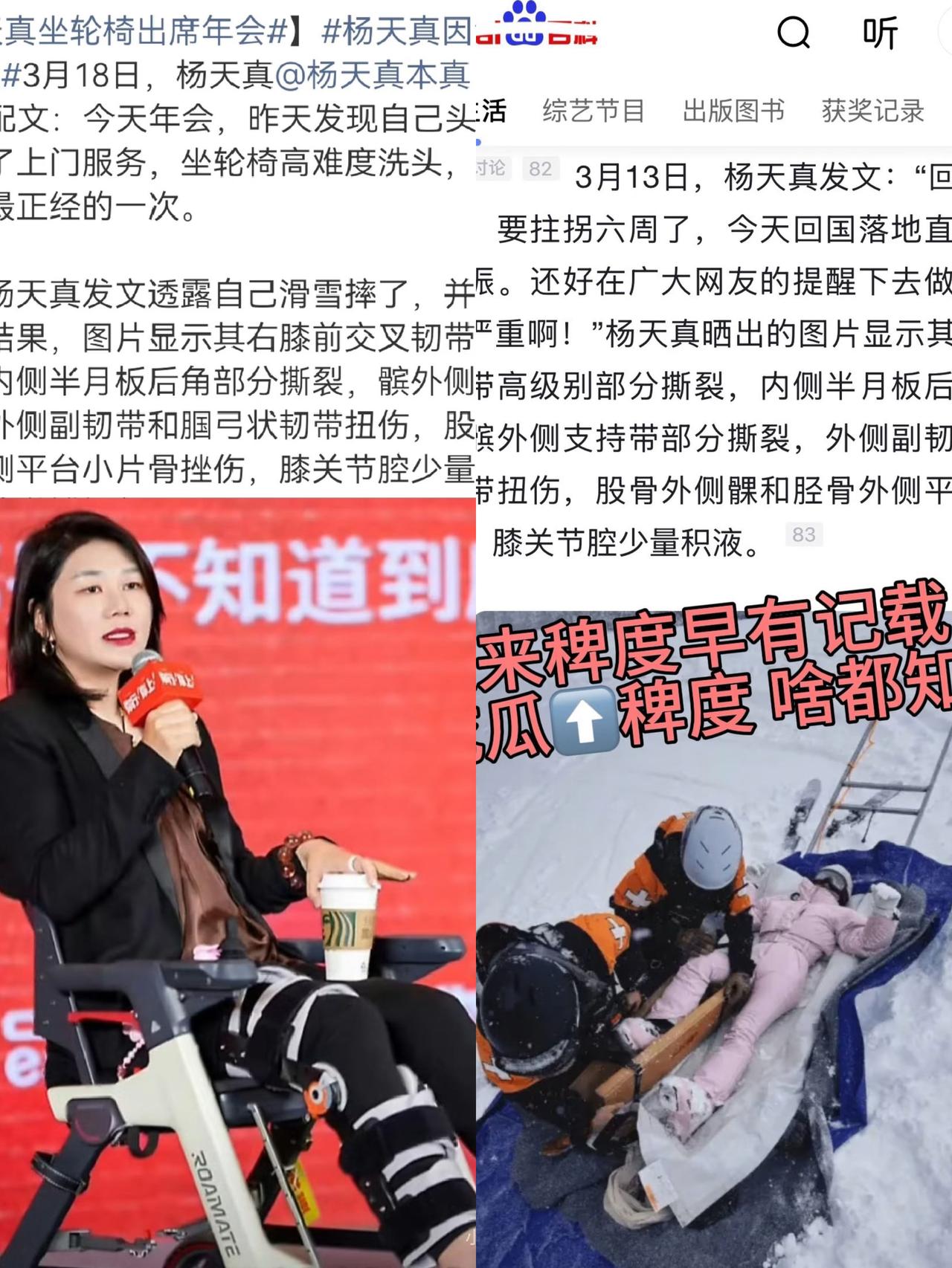 太佩服杨天真了

她说减肥直接减了50斤

她摔断了腿，坐轮椅也要去参加年会
