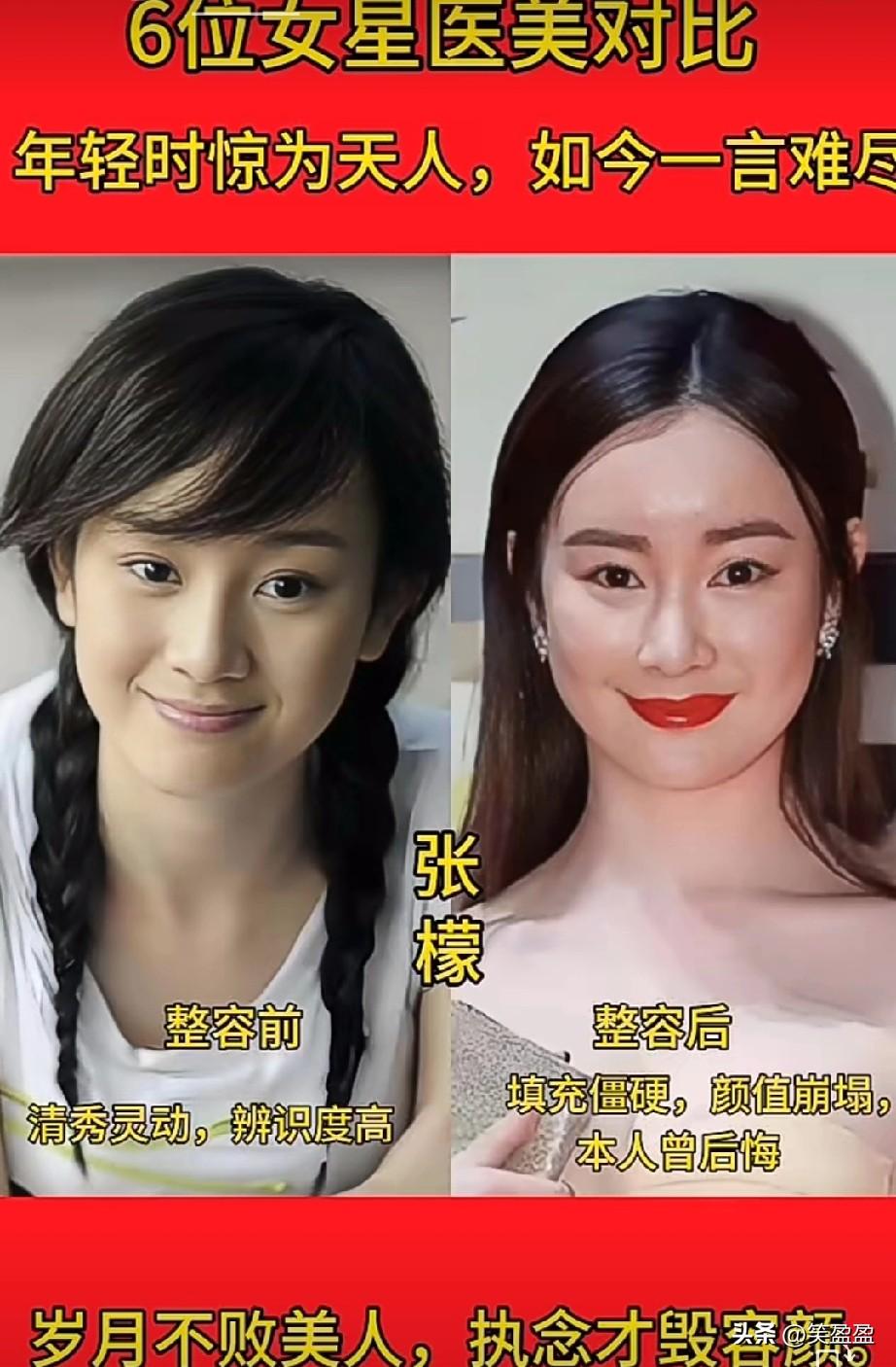 六位女星医美对比，
你觉得谁最可惜？